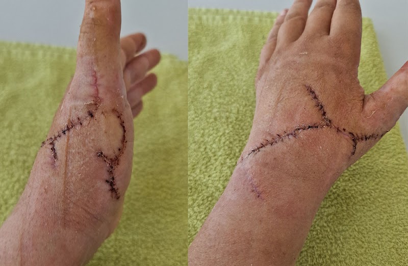 Ergo- & Handtherapie Ingo Kneppel